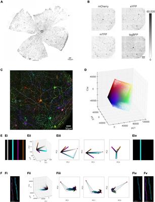 Quantitative characterisation of ipRGCs in retinal degeneration using a computation platform for extracting and reconstructing single neurons in 3D from a multi-colour labeled population